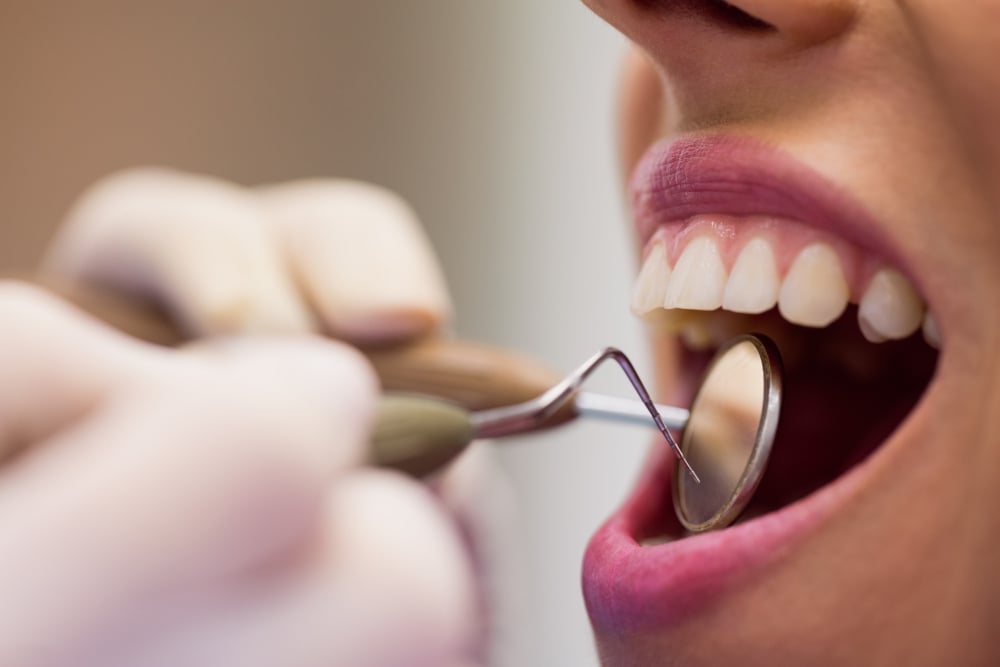 Des consultations d'hygiène dentaire professionnelle doivent néanmoins être effectuées Des consultations d'hygiène dentaire professionnelle doivent néanmoins être effectuées